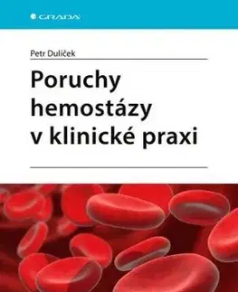 Poruchy hemostázy v klinické praxi - Petr Dulíček