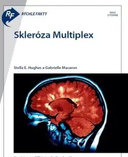 Rýchle fakty : Skleróza multiplex
