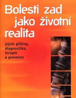 Bolesti zad jako životní realita - Blanka Beránková, Jan Hnízdil
