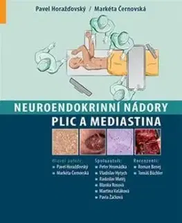 Neuroendokrinní nádory plic a mediastina - Pavel Horažďovský