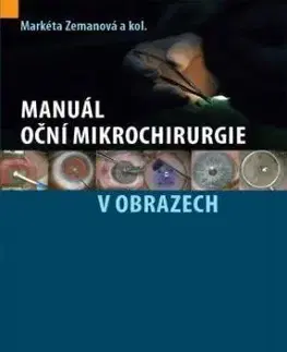 Manuál oční mikrochirurgie v obrazech - Markéta Zemanová