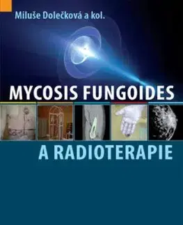 Mycosis fungoides a radioterapie - Miluše Dolečková