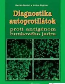 Diagnostika autoprotilátok proti antigénom bunkové - Marián Benčat, Július Rajčáni