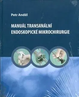 Manuál transanální endoskopické mikrochirurgie - Anděl Petr