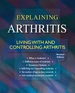 An Emerald Guide to Explaining Arthritis - Ellen Baxendale