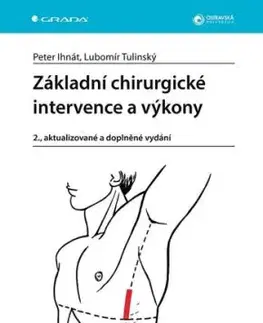 Základní chirurgické intervence a výkony, 2., aktualizované a doplněné vydání - Lubomír Tulinský, Peter Ihnát