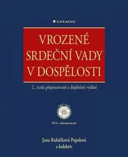 Vrozené srdeční vady v dospělosti + DVD - 2. vydání - Jana Rubáčková Popelová