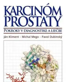 Karcinóm prostaty - Ján Kliment, Michal Mego, Pavol Dubinský