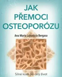 Jak přemoci osteoporózu - Anna Maria Lajusticia Bergasa