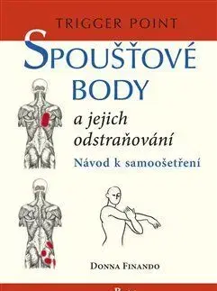 Spoušťové body a jejich odstraňování - Donna Finando