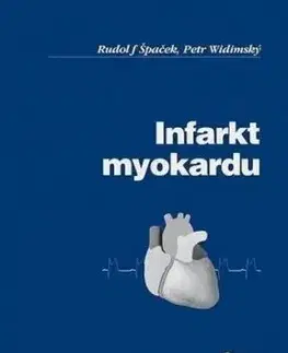 Infarkt myokardu