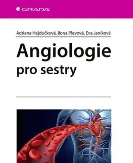 Angiologie pro sestry - Adriana Hajdučková, Ilona Plevová, Eva Janíková