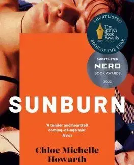 Sunburn - Chloe Michelle Howarth