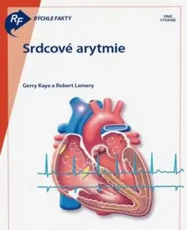 Rýchle fakty: Srdcové arytmie