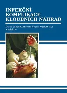 Infekční komplikace kloubních náhrad - David Jahoda