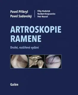 Artroskopie ramene, 2. vydání - Pavel Přikryl, Pavel Sadovský