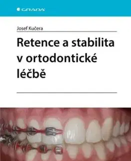 Retence a stabilita v ortodontické léčbě - Josef Kučera
