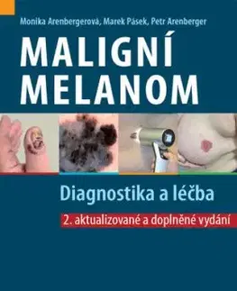 Maligní melanom: Diagnostika a léčba, 2. vydání