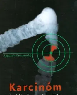 Karcinóm hrubého čreva a konečníka + CD - Augustín Prochotský