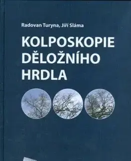 Kolposkopie děložního hrdla - Radovan Turyna