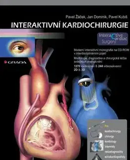Interaktivní kardiochirurgie – CD–ROM - Pavel Žáček, Dominik Jan, Pavel Kubiš