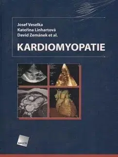 Kardiomyopatie - David Zemánek, Josef Veselka, Kateřina Linhartová