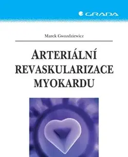 Arteriální revaskularizace myokardu - Marek Gwozdziewicz