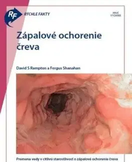 Rýchle fakty: Zápalové ochorenie čreva