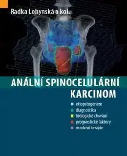 Anální spinocelulární karcinom - Radka Lohynská