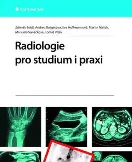Radiologie pro studium i praxi - Zdeněk Seidl