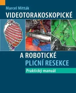 Videotorakoskopické a robotické plicní resekce - Praktický manuál - Marcel Mitták
