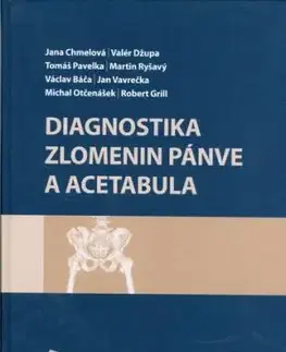 Diagnostika zlomenin pánve a acetabula