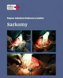 Sarkomy - Dagmar Adámková Krákorová