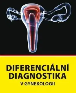 Diferenciální diagnostika v gynekologii - Pavel Cepicky