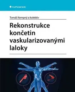 Rekonstrukce končetin vaskularizovanými laloky - Tomáš Kempný