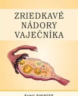 Zriedkavé nádory vaječníka - Kamil Biringer