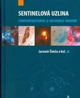 Sentinelová uzlina - Jaromír Šimša