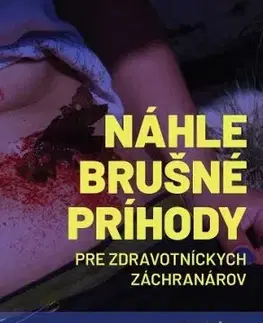 Náhle brušné príhody pre zdravotníckych záchranárov - Marián Šanta, Silvia Farkašová Iannaccone, Imrich Andrási