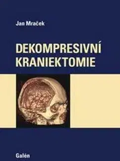 Dekompresivní kraniektomie - Jan Mraček