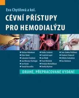 Cévní přístupy pro hemodialýzu, 2. vydání - Eva Chytilová