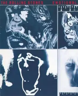 Rolling Stones, The - Emotional Rescue (2009 Re-mastered/Half Speed/New Cover Art) LP - The Rolling Stones