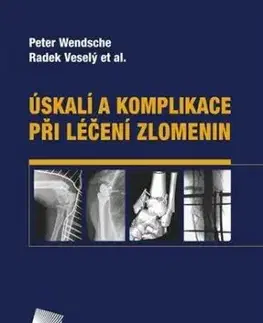 Úskalí a komplikace při léčení zlomenin - Peter Wendsche, Radek Veselý