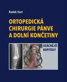 Ortopedická chirurgie pánve a dolní končetiny - Radek Hart