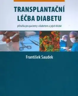 Transplantační léčba diabetu - František Saudek