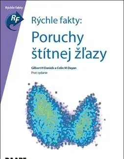 Rýchle fakty : Poruchy štítnej žľazy
