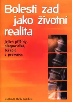 Bolesti zad jako životní realita - Blanka Beránková, Jan Hnízdil