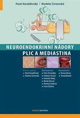 Neuroendokrinní nádory plic a mediastina - Pavel Horažďovský