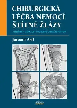 Chirurgická léčba nemocí štítné žlázy - Jaromír Astl