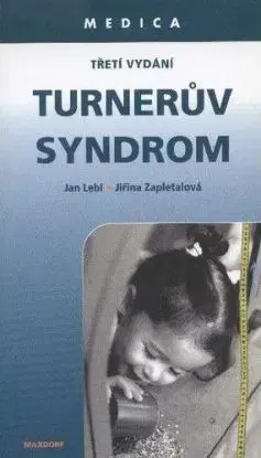 Turnerův syndrom - Jan Lebl
