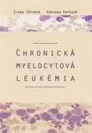 Chronická myelocytová leukémia - Adriana Kafková, Elena Tóthová